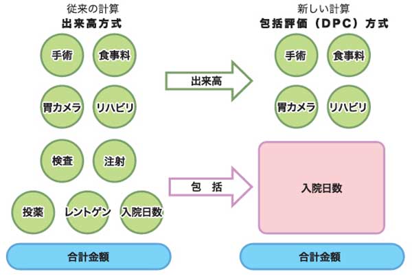 大学病院へのDPC導入